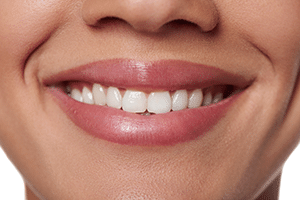 teeth whitening img1